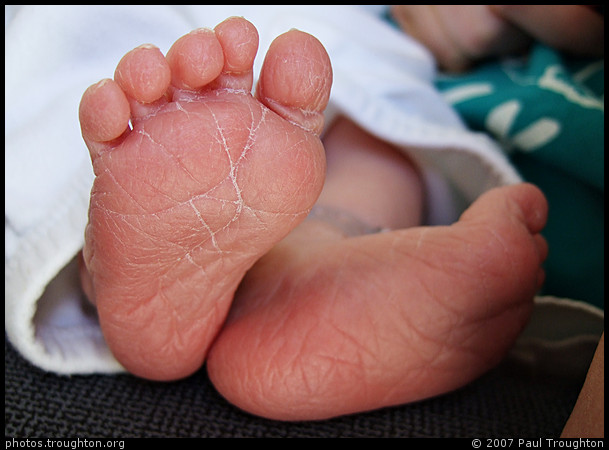 Extraordinarily wrinkly feet - Dominic's first month